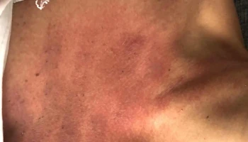 Clinica Gioscia Medicina del Deporte - Montevideo