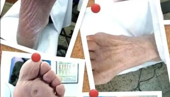 Consultorio Podología Unión - Técnica Hab. por M.s.p - Fray Bentos 3366 Consultorio Podología Unión - Técnica Hab. por M.s.p - Fray Bentos 3366