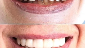 Dental Restyling - Montevideo