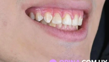 Dra Noe Mendoza - Montevideo