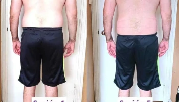 Franca Estética Integral | Tratamientos Faciales y Corporales | Eliminación de celulitis | Adiposidad | Radiofrecuencia - Montevideo Franca Estética Integral | Tratamientos Faciales y Corporales | Eliminación de celulitis | Adiposidad | Radiofrecuencia - Montevideo