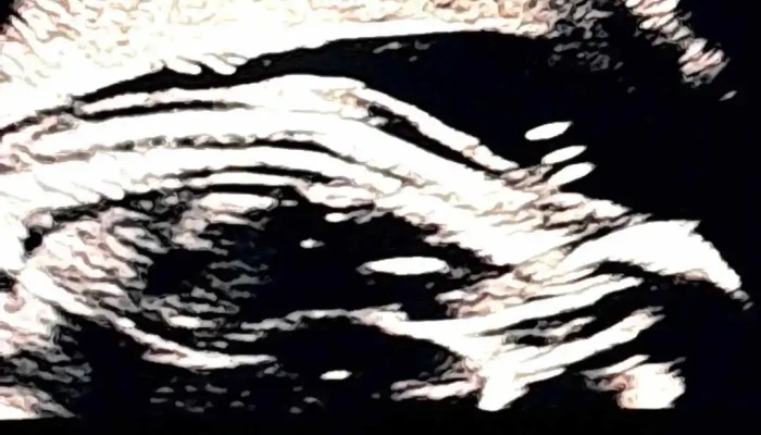 Ateneo Medico Videos - Montevideo