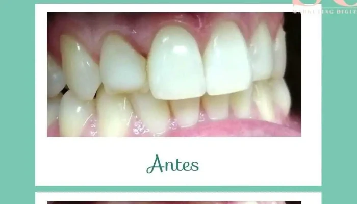 Bienestar Dental -    Consultorio Odontologico Videos - Montevideo