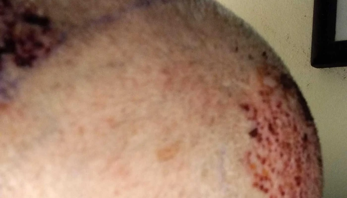 Capilea -  Fotos - Montevideo