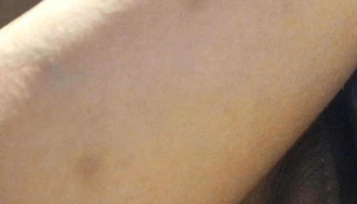 Centro Aconcagua Cordon Fotos - Montevideo