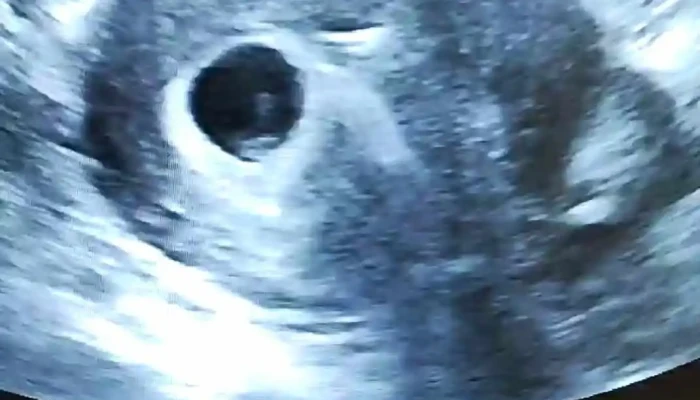 Centro De Ecografia De Alta Definicion Del Propietario - Montevideo