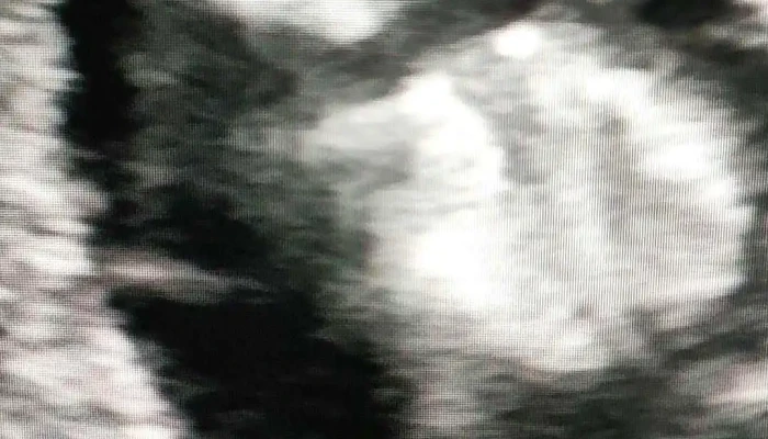 Centro De Ecografia De Alta Definicion Videos - Montevideo