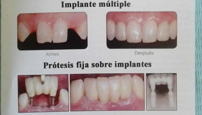 Centro Odontologico Pocitos -  Diente - Montevideo