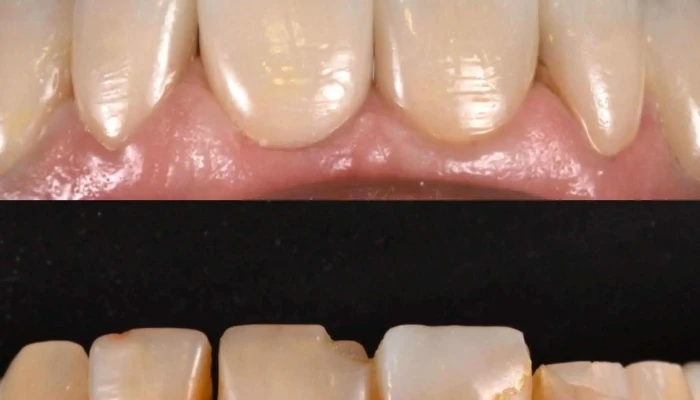 Clinica Ciardi Diente - Montevideo