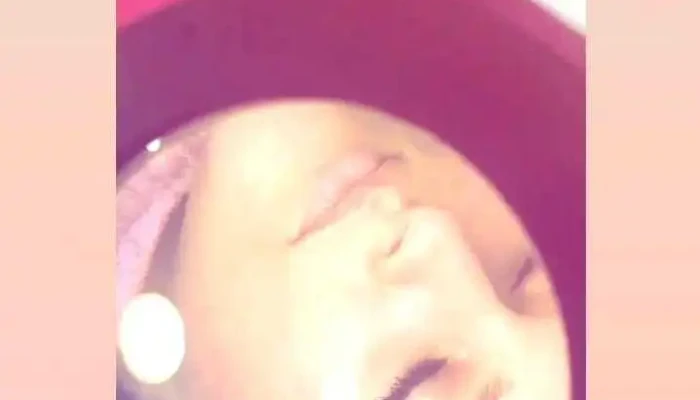 Clinica Estetica Colon Videos - Montevideo