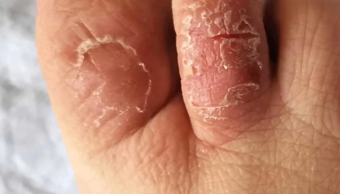 Clinica Integral Del Pie Ubicacion - Atlántida