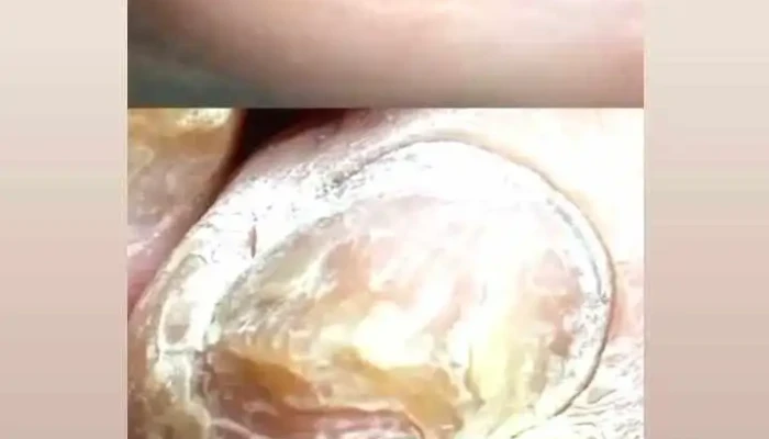 Clinica Integral Del Pie Videos - Atlántida