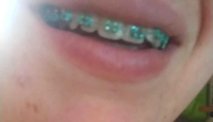 Clinica Odontologica Descuentos - Montevideo