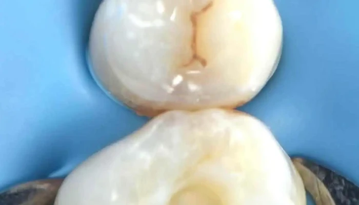 Clinica Odontologica Digital Lhasa Videos - Montevideo