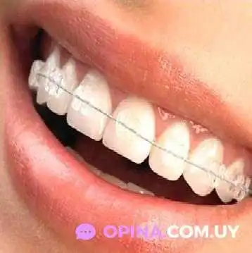 Consultorio Dental Uy -    Odontologo Diente - Montevideo