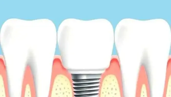 Dental Arenas -  Diente - Montevideo