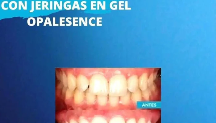 Dental Montecaseros -  Diente - Montevideo