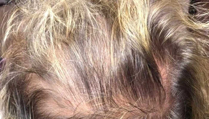 Dernova -  Videos - Montevideo