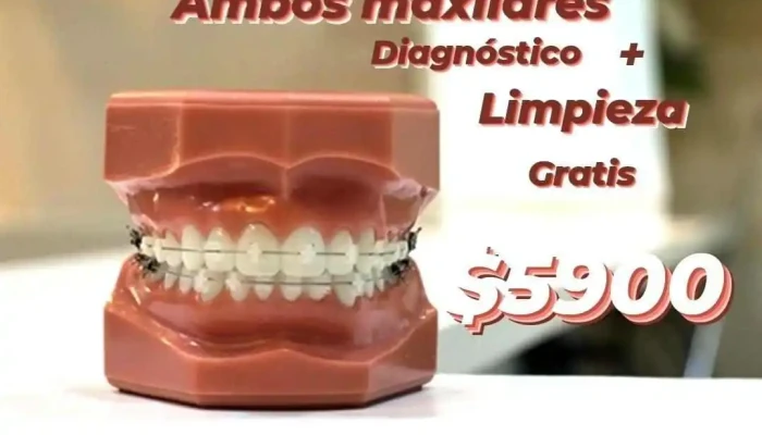 Dr Brackets -  Diente - Villa García