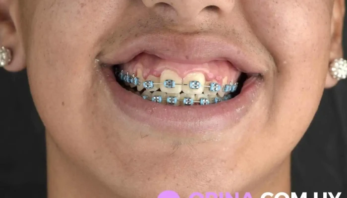 Dra Noe Mendoza -  Del Propietario - Montevideo