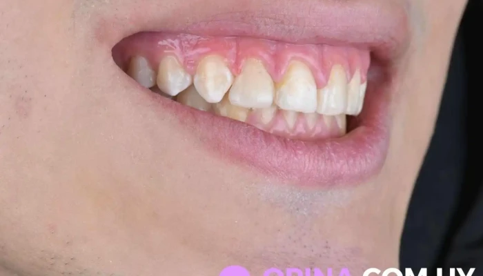 Dra Noe Mendoza - Montevideo