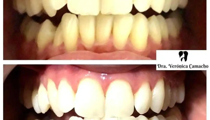 Dra Veronica Camacho   Clinica Odontologica Estetica Facial Diente - Montevideo