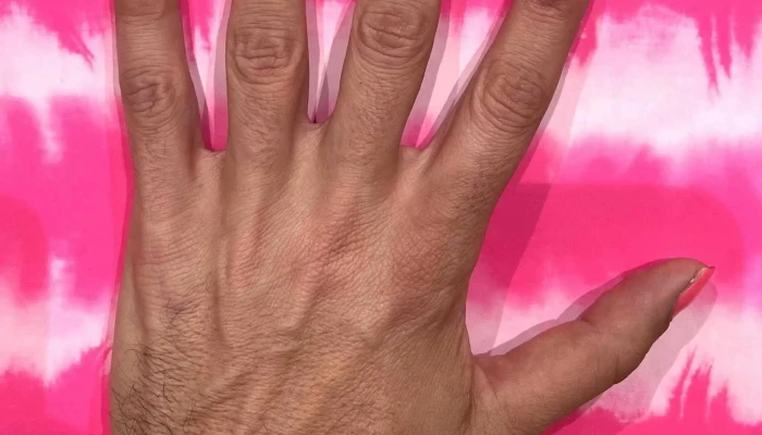 Infantozzi -  Ubicacion - Montevideo