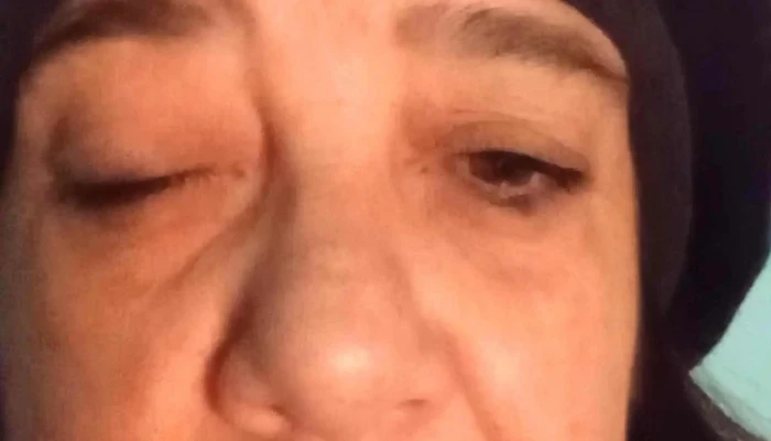 Instituto Nacional de Ortopedia y Traumatología - Montevideo