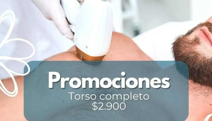 Kalosuy Abierto Ahora - Montevideo