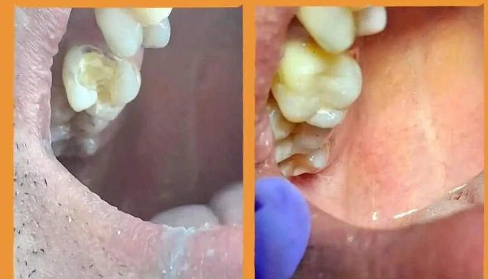 Mvd Sonrisa Salud Diente - Montevideo