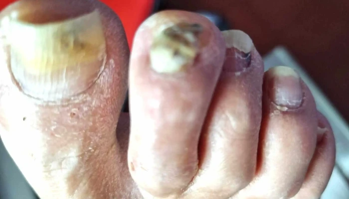 Nair Giro Tecnico En Podologia Mas Recientes - Piriápolis