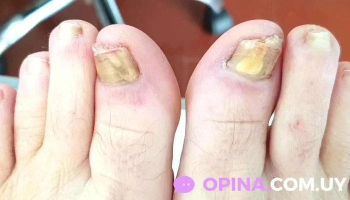 Nair Giro Tecnico En Podologia Videos - Piriápolis