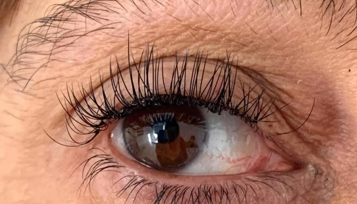 Odette -    Estetic Center Del Propietario - Carmelo