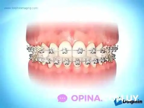 Odontologia Integral Malvin Diente - Montevideo