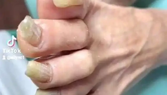 Podologa Punta Del Este Maldonado Consultorio Podologico Del Propietario - Maldonado