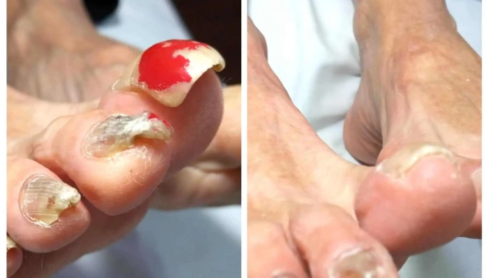 Podologa Punta Del Este Maldonado Consultorio Podologico Puntaje - Maldonado