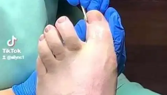 Podologa Punta Del Este Maldonado Consultorio Podologico Videos - Maldonado