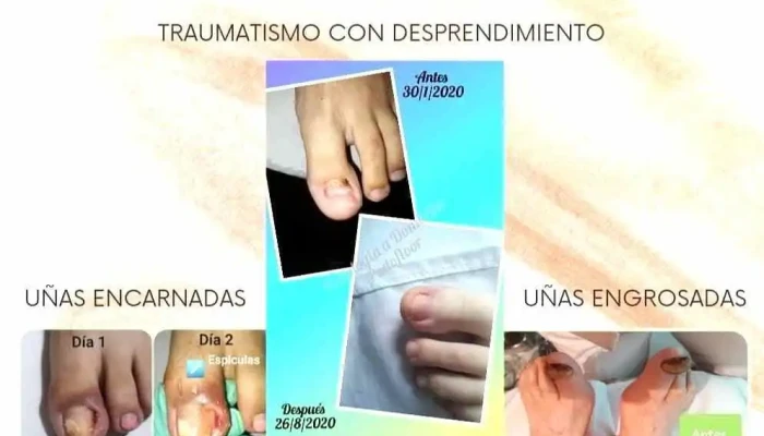 Podologia Podofloor Del Propietario - Paysandú