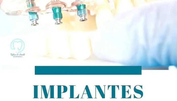 Relax Smile Diente - Montevideo