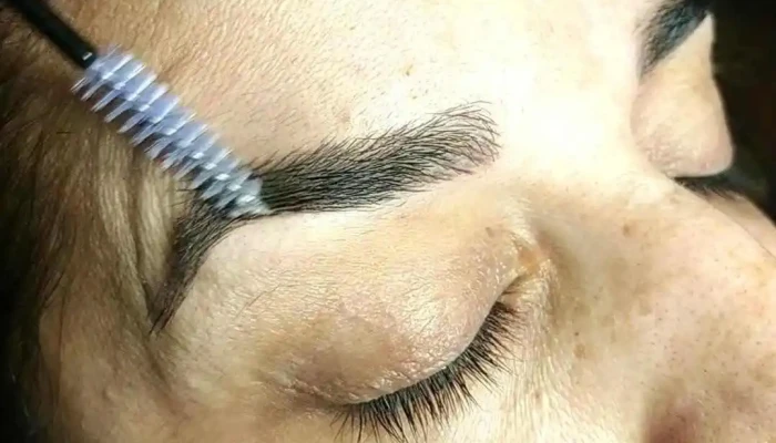 Santangelo Estetica Derma Corporal Videos - Montevideo