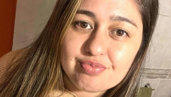 Yess Penino Clinica Nanopigmentacion Nanoblading Nanolips Tatuaje 3d Pezon Cerca De Mi - Montevideo