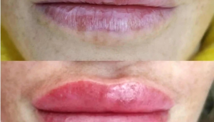 Yess Penino Clinica Nanopigmentacion Nanoblading Nanolips Tatuaje 3d Pezon Donde - Montevideo