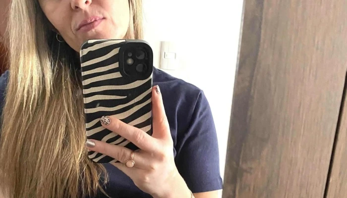 Yess Penino Clinica Nanopigmentacion Nanoblading Nanolips Tatuaje 3d Pezon Promocion - Montevideo